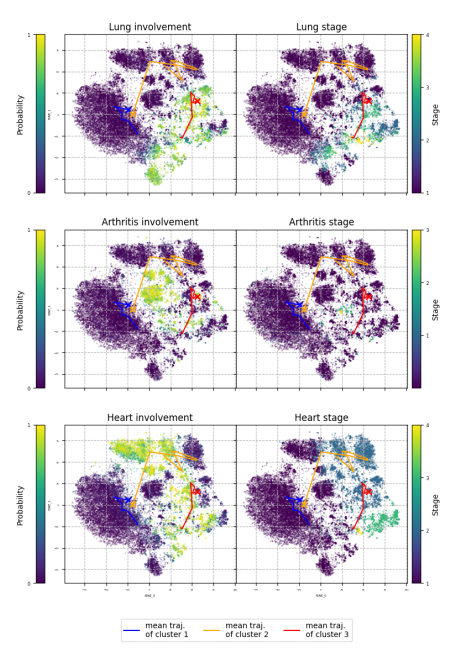 You can predict disease progression by modeling health data in latent space